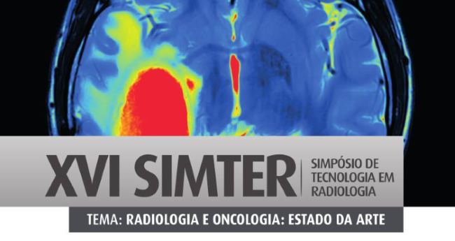 noticia-content-radio.png