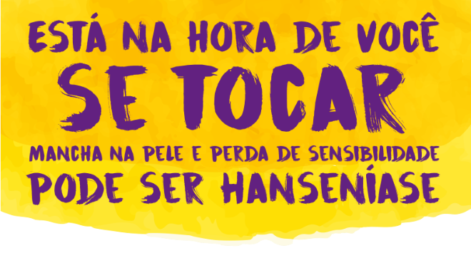 noticia-content-topo_1_mh.png